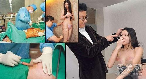 整形手术爆料视频大全,爆料视频大全深度解析 第3张 整形手术爆料视频大全,爆料视频大全深度解析 第3张